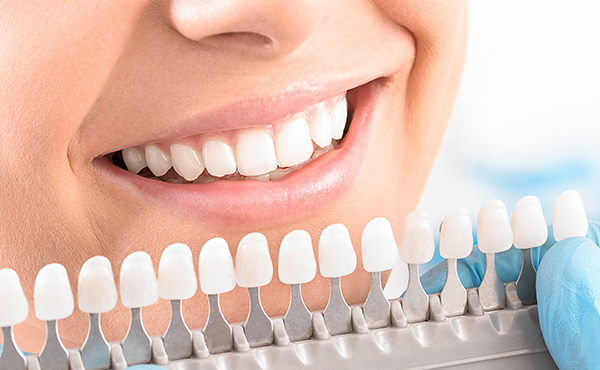 Tooth whitening