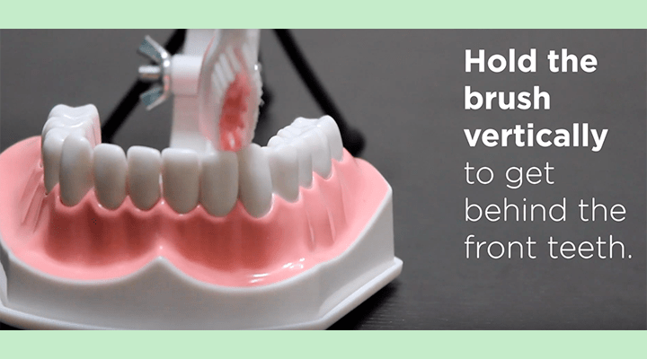 fake teeth, overlay hold the brush vertically to get behind the front teeth.