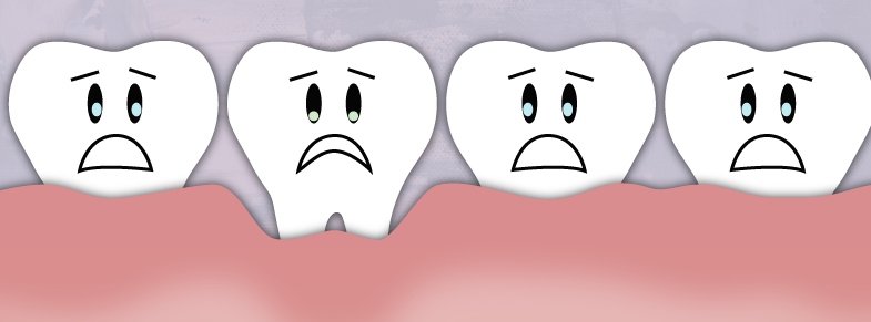 animation of receding gums over teeth