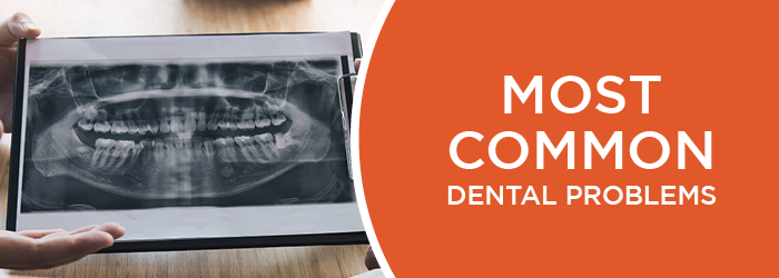 most common dental problems