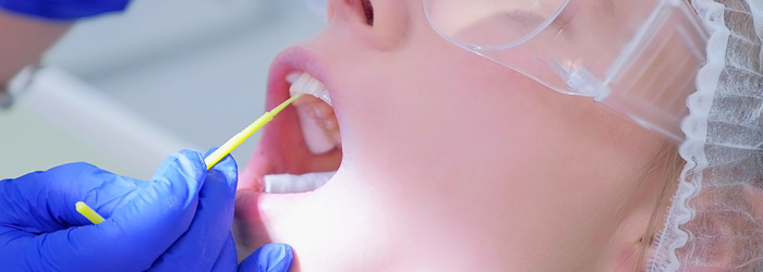 How does Silver Diamine Fluoride Work