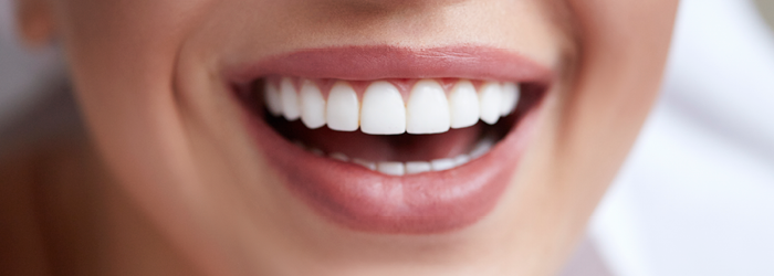 Teeth whitening
