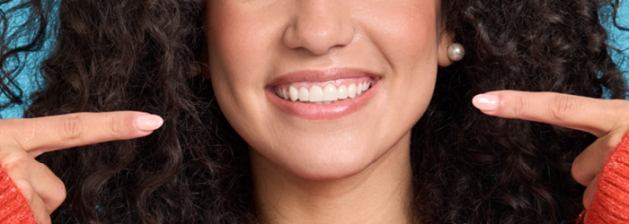 What are veneers